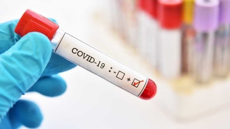 31 нови случая на коронавирус са били регистрирани през последното денонощие в