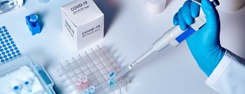 60 нови случая на заразени с COVID 19 са регистрирани в