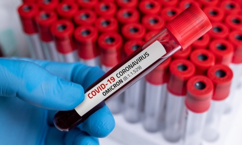 Новите потвърдени случаи на коронавирус у нас за последното денонощие са