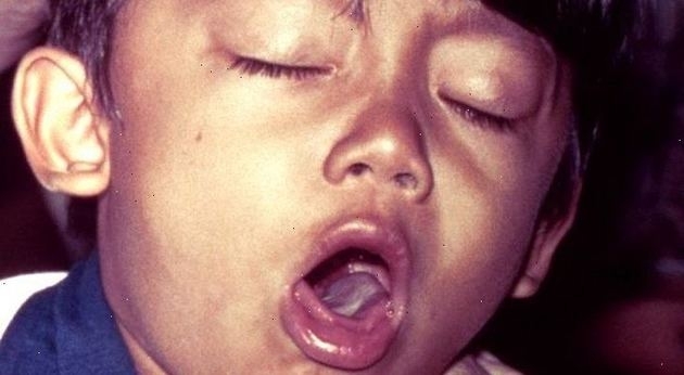 През изминалата седмица във Врачанско са регистрирани случаи на четири