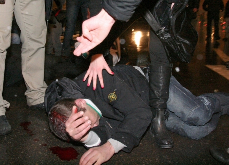 Ученик се размина с пробация за това че избил зъбите