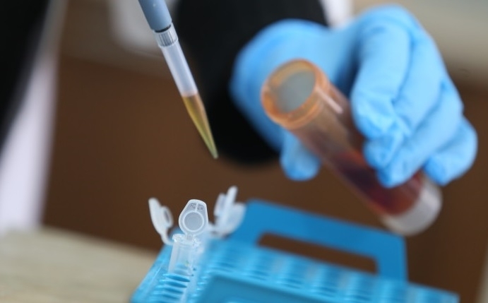 35 са новодиагностицираните с COVID 19 лица в България през последните