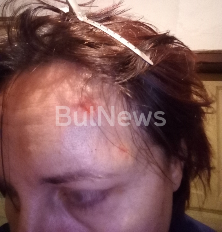 Информационна агенция BulNews се сдоби с ексклузивни снимки на пребитата