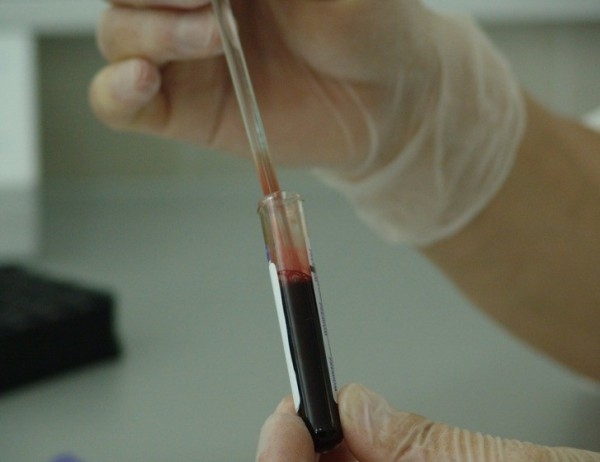 На 26 03 2018 г от 10 00 13 00 часа във фоайето на поликлиниката