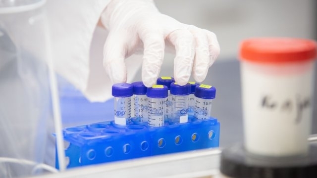 Новите потвърдени случаи на коронавирус у нас за последното денонощие