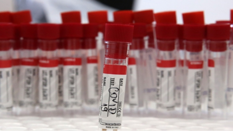 535 са новодиагностицираните с коронавирусна инфекция лица през изминалите 24