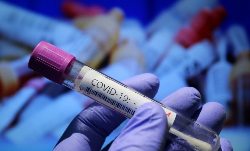 Новите потвърдени случаи на коронавирус у нас за последното денонощие