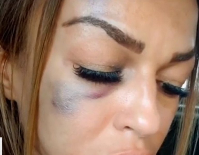 56 годишен мъж преби съпругата си в Перник съобщиха от полицията За спор и последвал