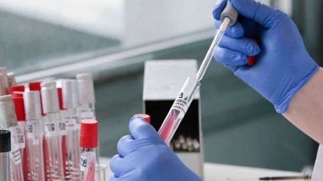 Броят на заразените с COVID 19 за последното денонощие е 22 показват данните