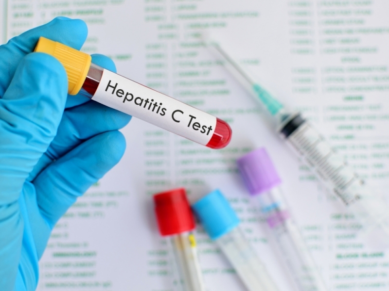 Около 90 хиляди са българите, болни от коварния вирус хепатит