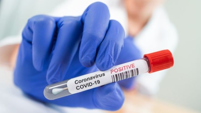 Броят на новите случаи на коронавирус за последното денонощие е