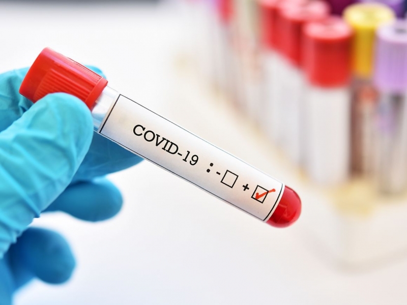 136 са новите случаи на коронавирус у нас за последното