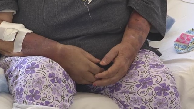 Мъж е пребил жена в центъра на врачанското село Нивянин