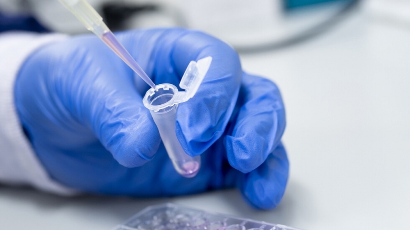 Близо всеки пети тест за коклюш в една от лабораториите у