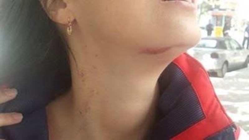 Мъж опита да удуши жена съобщиха от полицията в Плевен
