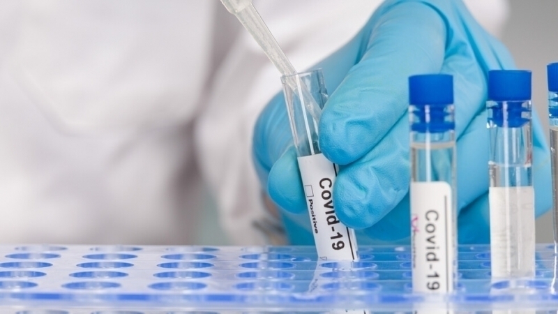 Седем нови случая на КОВИД 19 са открити през последните 24