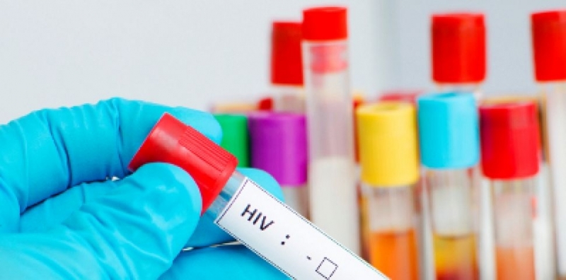 Ново научно откритие може да сложи край на ХИВ Мъже