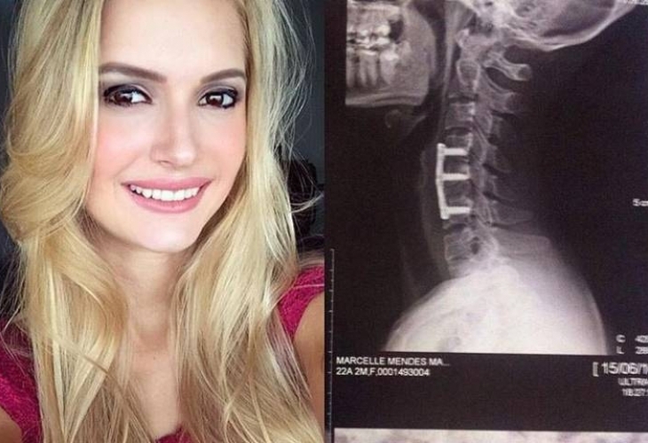 Известната бразилска модзелка Марсел Манкусо била активна спортистка Понякога 23 годишната