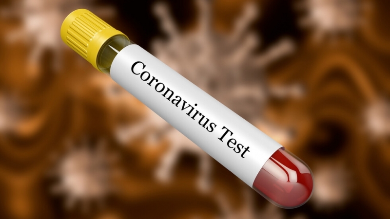 Първи смъртен случай от коронавируса извън Китай е регистриран във Филипините
