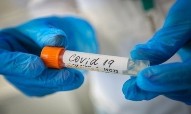 42 са новите случаи на зараза с COVID 19 за