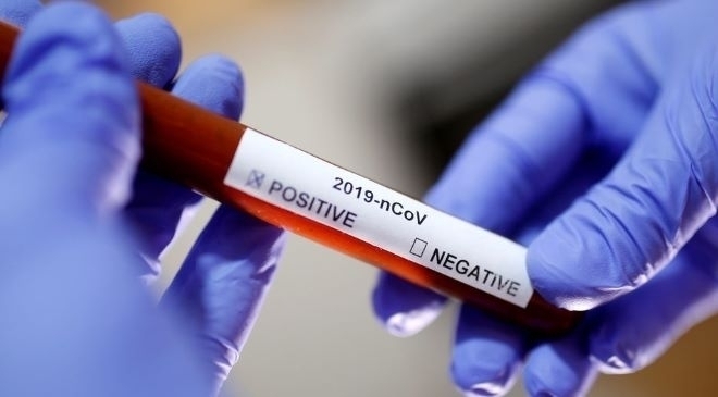 66 нови случая на коронавирус са били регистрирани през последното