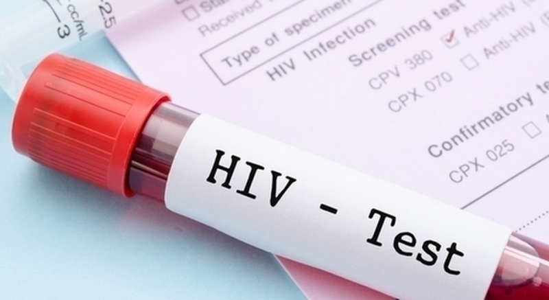 Здравната инспекция в Монтана регистрира пациент с ХИВ инфекция научи