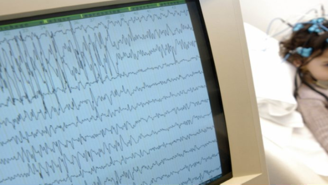 Нова апаратура в клиниката по детска неврология в Университетската болница