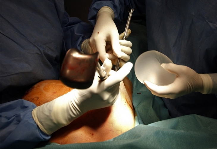 Силиконките у нас минаха на южнокорейски импланти Те ги предпочитат