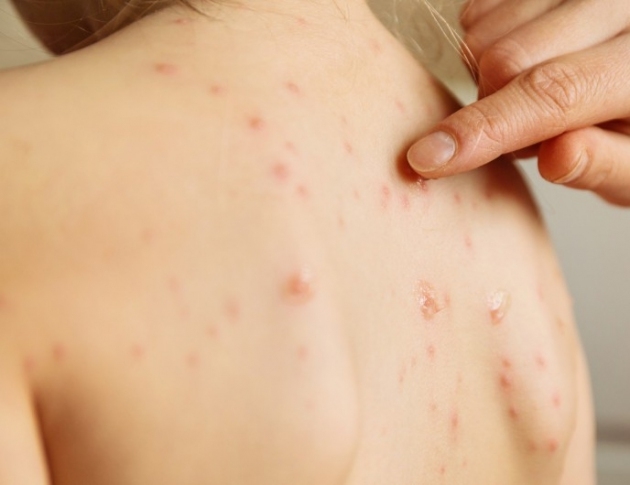 За изминалата седмица 24 жители на област Видин са пипнали